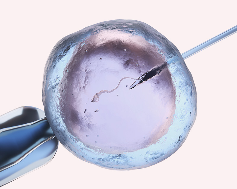 In-vitro fertilization; third party evaluations to grow your family